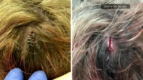 Heridas cabalgata Utrera Heridas cabalgata Utrera