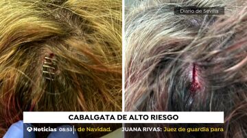 Varios herido en la Cabalgata de Reyes de Utrera: "A una amiga la rajaron el brazo"