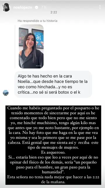 Story Noelia López Story Noelia López