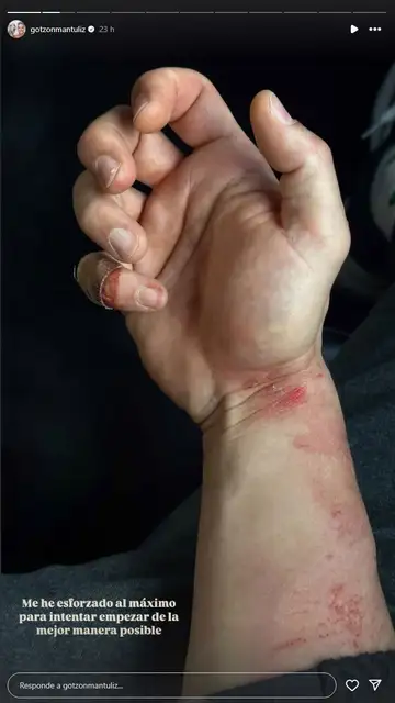 Heridas de Gotzon Heridas de Gotzon