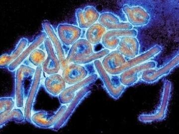 Alarma mundial por el virus de Marburgo: mata al 90% de los infectados