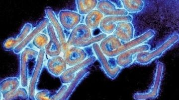 Alarma mundial por el virus de Marburgo: mata al 90% de los infectados