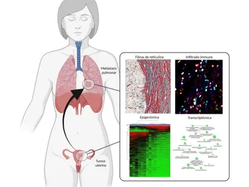 Estos son los síntomas que las mujeres no deben ignorar porque son señales de alerta del cáncer de cuello uterino Estos son los síntomas que las mujeres no deben ignorar porque son señales de alerta del cáncer de cuello uterino