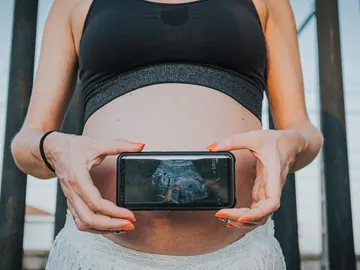 Una mujer embarazada muestra una imagen de la placenta desde dentro Una mujer embarazada muestra una imagen de la placenta desde dentro