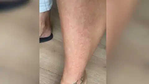 Vecina afectada Vecina afectada