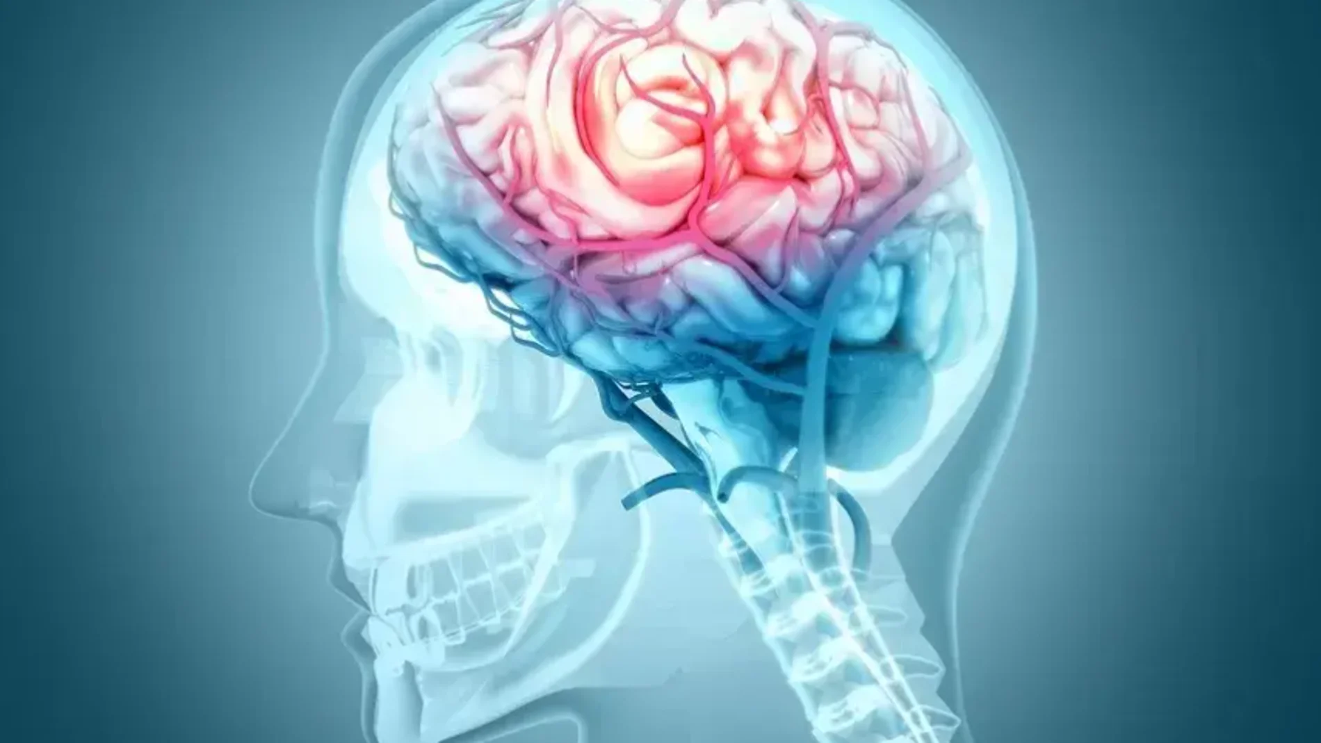 El divorcio de los padres en la infancia aumenta un 61% el riesgo de sufrir un ictus en la edad adulta El divorcio de los padres en la infancia aumenta un 61% el riesgo de sufrir un ictus en la edad adulta