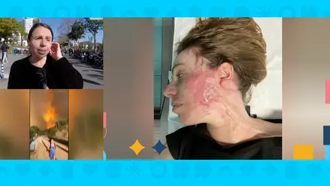 Arruinada tras quemarse en el tren. Arruinada tras quemarse en el tren.