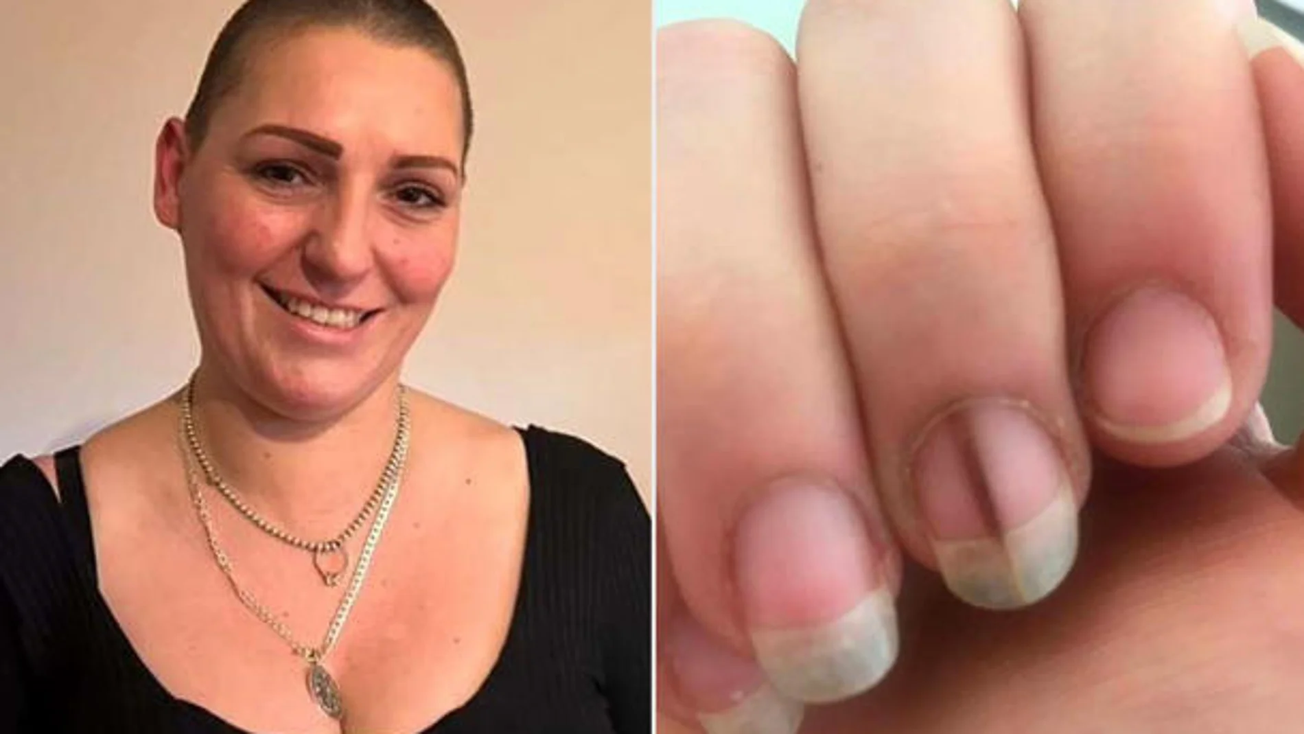 El cambio en la uña de la mujer El cambio en la uña de la mujer