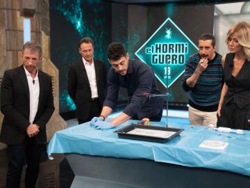 &iexcl;Qu&eacute; precisi&oacute;n! As&iacute; salvan la vida los cardi&oacute;logos a un paciente que ha sufrido un infarto