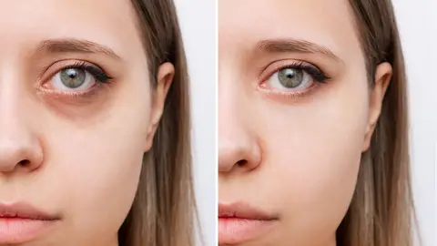 Imagen de mujer con signos de cansancio en el rostro y sin ellos Imagen de mujer con signos de cansancio en el rostro y sin ellos