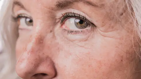 Patas de gallo Patas de gallo