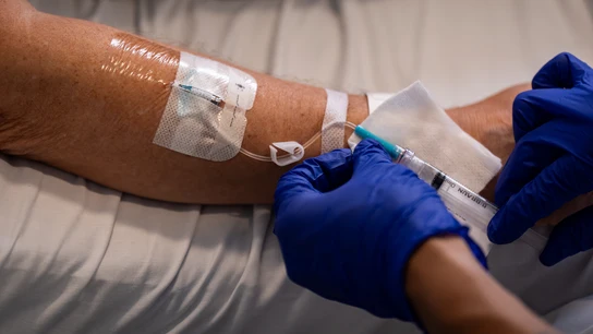 Un dolor bajo las costillas terminó en un inesperado diagnóstico de cáncer Un dolor bajo las costillas terminó en un inesperado diagnóstico de cáncer