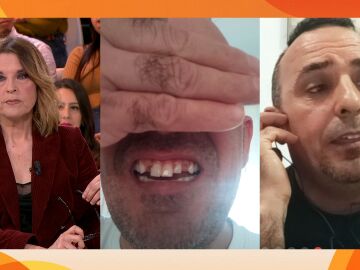 Dientes