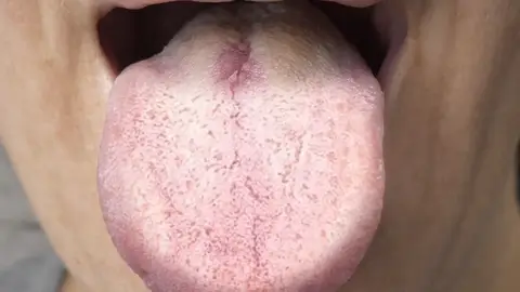 Si tu lengua tiene este color, tu cuerpo podría estar enviando una señal de alerta Si tu lengua tiene este color, tu cuerpo podría estar enviando una señal de alerta