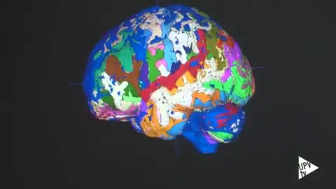 El cerebelo, al descubierto gracias a un sistema informático pionero El cerebelo, al descubierto gracias a un sistema informático pionero: “Como pasar una imagen de blanco y negro a otra de color”