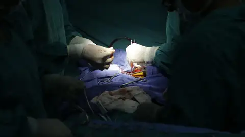 Imagen de archivo de una operación Imagen de archivo de una operación