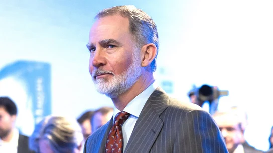 El rey Felipe VI aparece quemado El rey Felipe VI aparece quemado