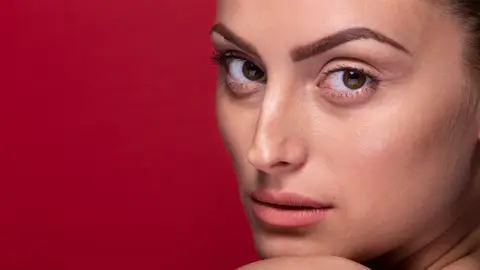 Mujer con ojeras vasculares Mujer con ojeras vasculares