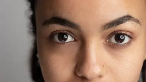 Mujer con ojeras pigmentadas Mujer con ojeras pigmentadas