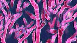 Imagen de archivo de un Aspergillus fumigatus observado al microscopio &oacute;ptico.