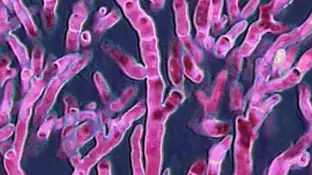 Imagen de archivo de un Aspergillus fumigatus observado al microscopio óptico. Imagen de archivo de un Aspergillus fumigatus observado al microscopio óptico.