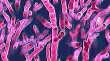 Imagen de archivo de un Aspergillus fumigatus observado al microscopio óptico.