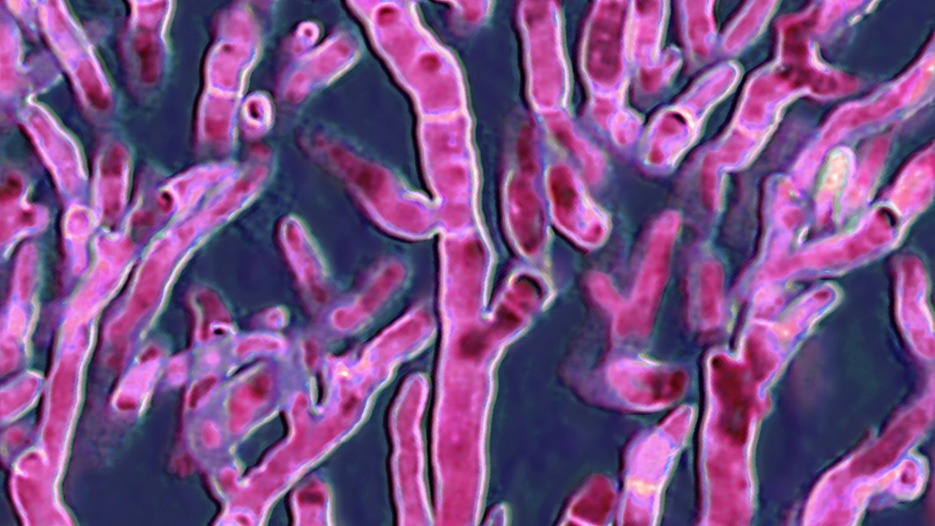 Imagen de archivo de un Aspergillus fumigatus observado al microscopio óptico. Imagen de archivo de un Aspergillus fumigatus observado al microscopio óptico.