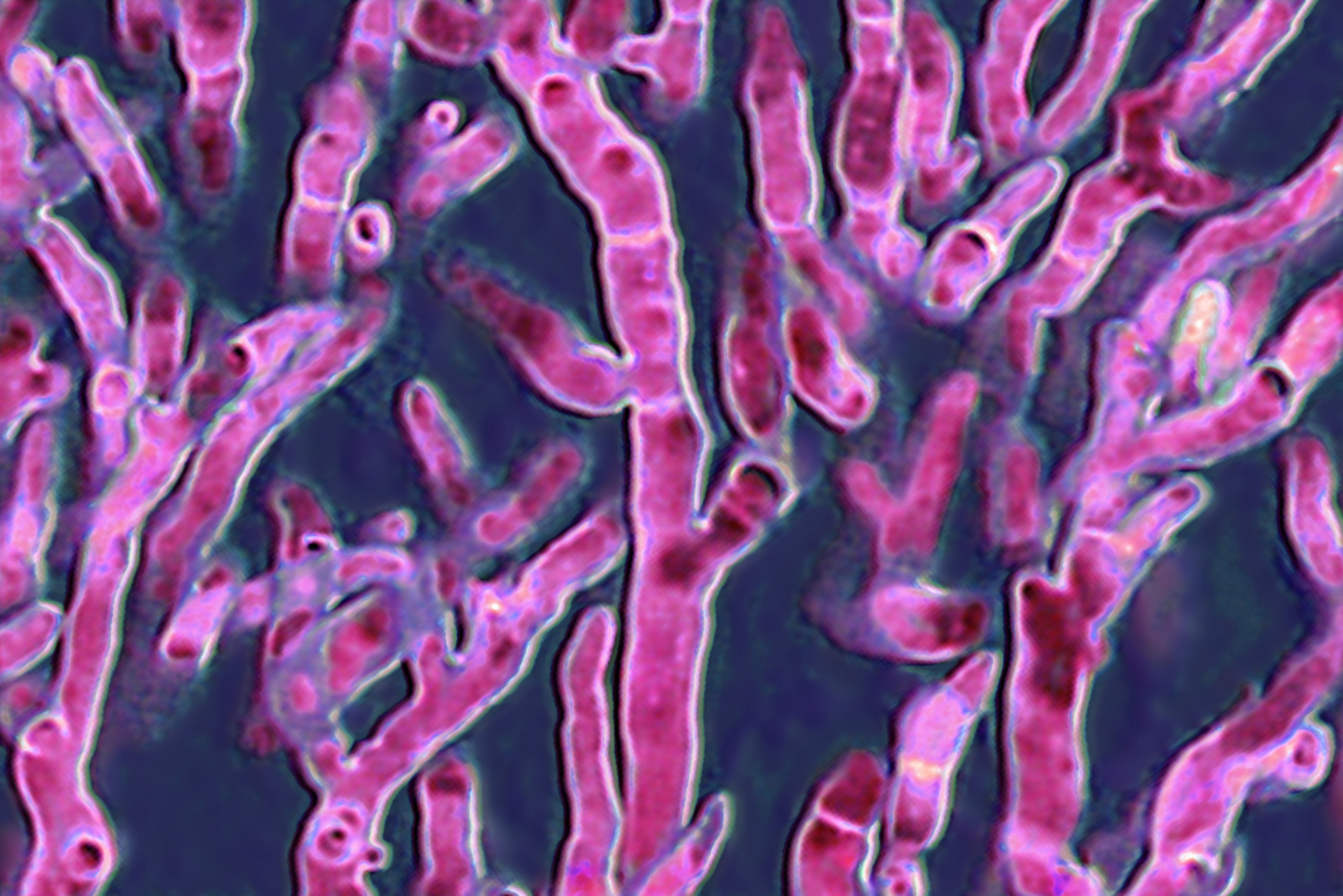 Imagen de archivo de un Aspergillus fumigatus observado al microscopio &oacute;ptico.