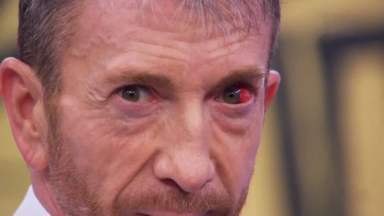 Pablo Motos confiesa el motivo del derrame en su ojo: "Ha sido en un entrenamiento de boxeo" Pablo Motos confiesa el motivo del derrame en su ojo: "Ha sido en un entrenamiento de boxeo"