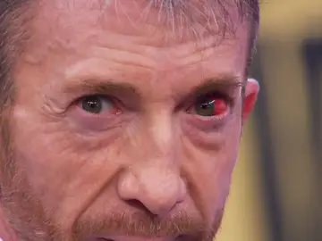 Pablo Motos confiesa el motivo del derrame en su ojo: "Ha sido en un entrenamiento de boxeo" Pablo Motos confiesa el motivo del derrame en su ojo: "Ha sido en un entrenamiento de boxeo"