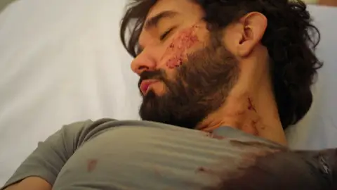 ¡La vida de Oliver corre peligro! Es disparado y debe ir inmediatamente al hospital… ¿sobrevivirá? ¡La vida de Oliver corre peligro! Es disparado y debe ir inmediatamente al hospital… ¿sobrevivirá?