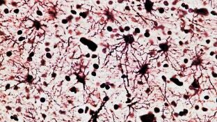 Image de neurona-c&eacute;lula nerviosa, vista al microscopio.