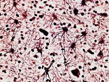 Image de neurona-célula nerviosa, vista al microscopio.