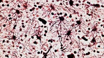 Image de neurona-célula nerviosa, vista al microscopio.