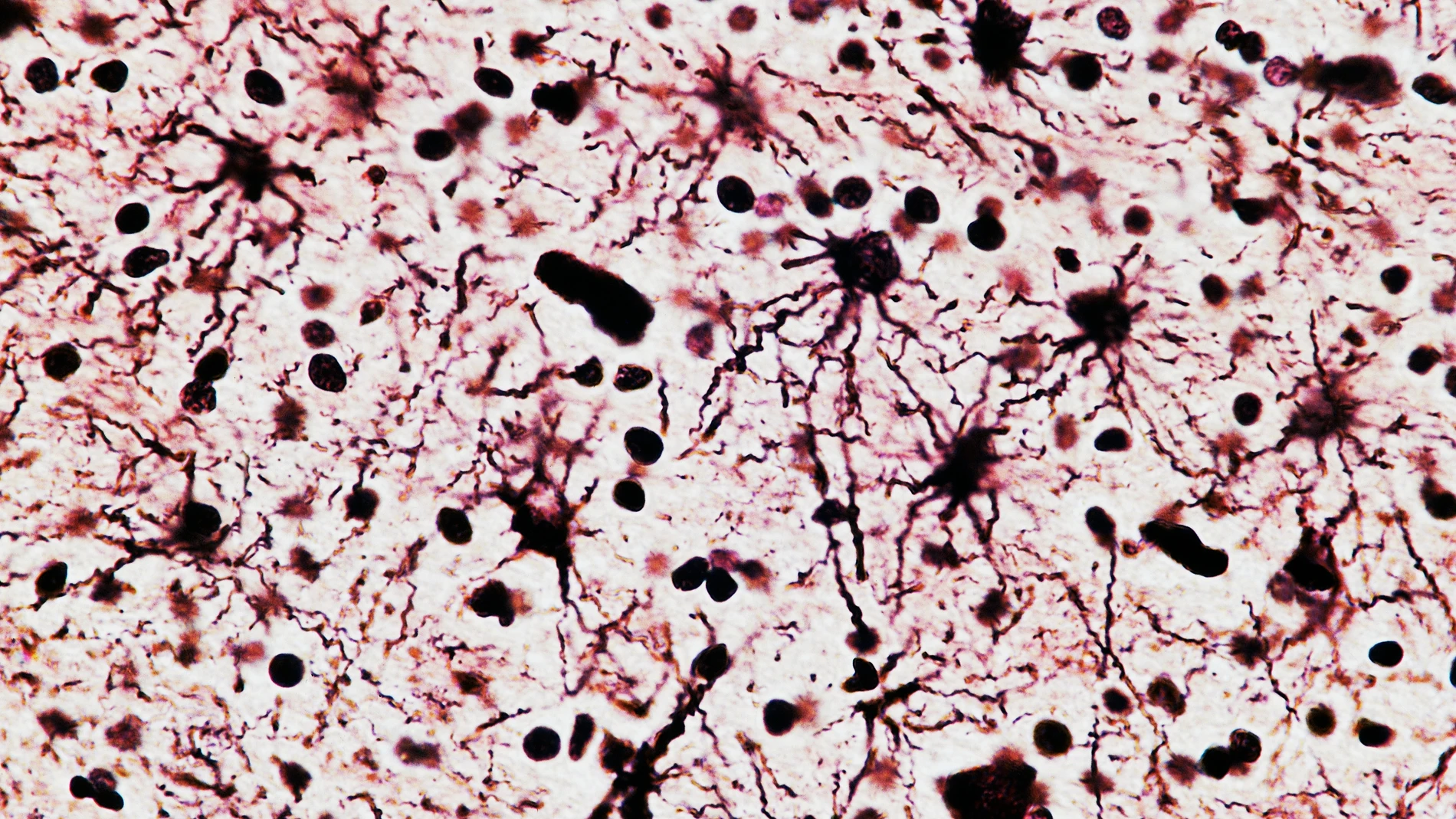 Image de neurona-célula nerviosa, vista al microscopio. Image de neurona-célula nerviosa, vista al microscopio.