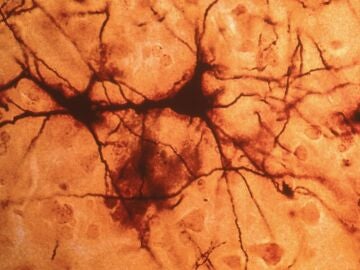 Imagen de una neurona. Imagen de una neurona.