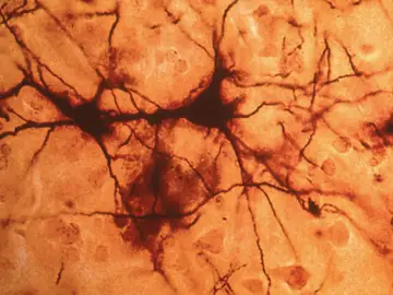 Imagen de una neurona. Imagen de una neurona.
