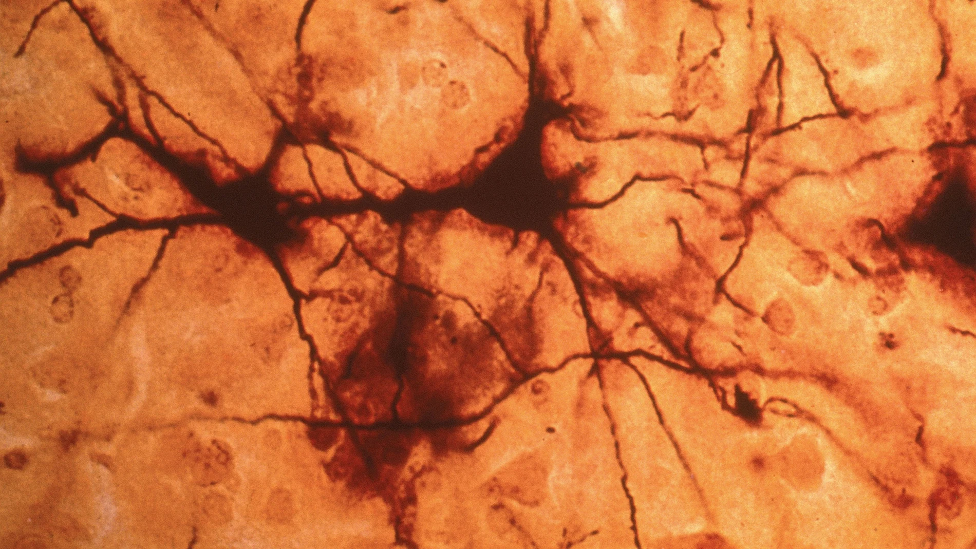 Imagen de una neurona. Imagen de una neurona.