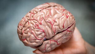 Imagen de archivo de un cerebro.