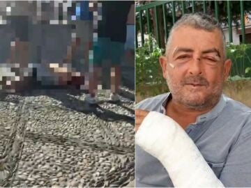 Agustín, víctima de una paliza en el Mirador de San Nicolás