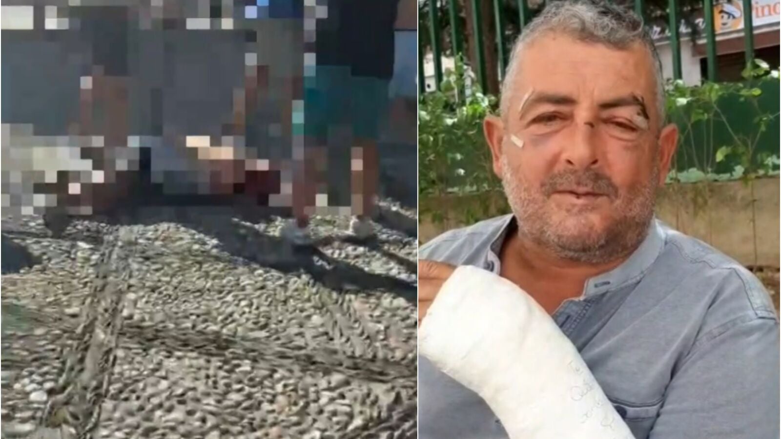 Duras imágenes | Brutal paliza a un músico por reprocharles que fumaran porros delante de niños en Granada: 