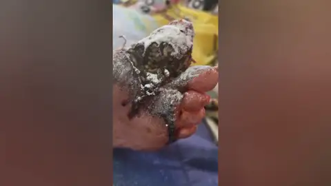 La mujer de origen marroquí fue hallada en un estado alarmante de abandono sanitario La mujer de origen marroquí fue hallada en un estado alarmante de abandono sanitario