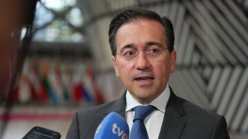 José Manuel Albares