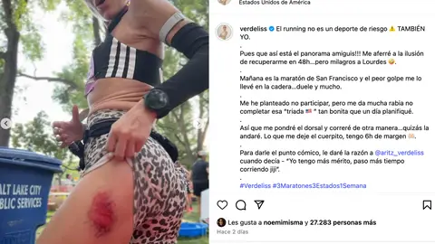 Verdeliss enseña las heridas de su última carrera Verdeliss enseña las heridas de su última carrera