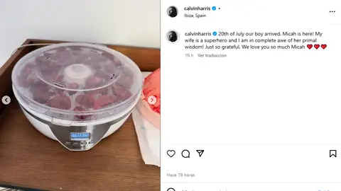 Placenta de la mujer de Calvin Harris siendo tratada Placenta de la mujer de Calvin Harris siendo tratada