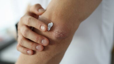 ¿Manchas oscuras en codos o axilas? Mezcla estos 3 ingredientes y conseguirás un remedio para aclararlas