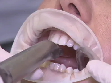 Consulta en el dentista Consulta en el dentista