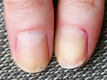 Uñas Uñas