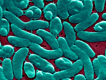 Imagen de la bacteria vista desde un microscopio 