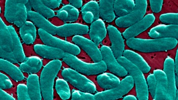 Imagen de la bacteria vista desde un microscopio 